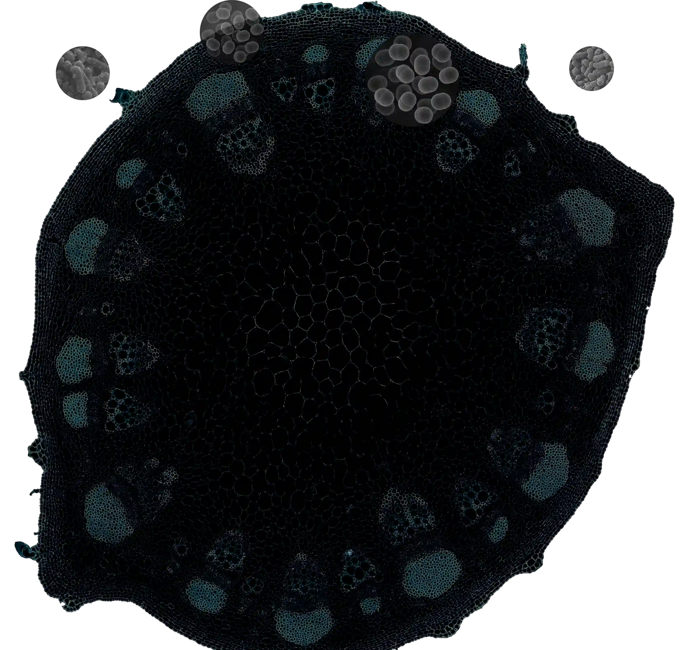 Microbiome Science is Changing Our Understanding of Prostate Enlargement